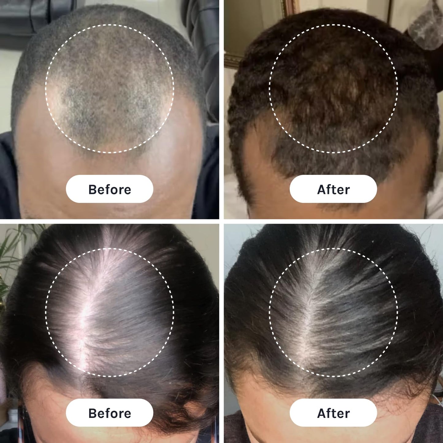 InfiniWell DUO- Hair Growth Serum and Scalp Rejuvenation