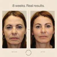 Nicebeam 9-in-1 Laser Light Therapy Lamp for Skin & Hair Rejuvenation
